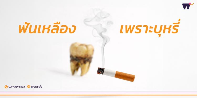 สูบบุหรี่แล้วฟันเหลือง แก้ยังไง? รวมวิธีรักษาให้ฟันขาวอย่างปลอดภัย