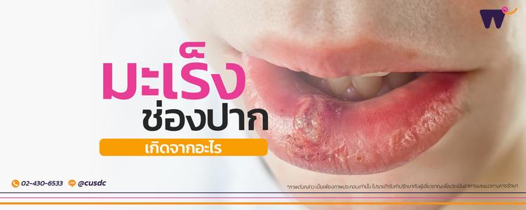 มะเร็งช่องปาก เกิดจากอะไร? รู้ปัจจัยเสี่ยงและสัญญาณเตือนก่อนลุกลาม