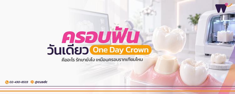 One Day Crown ครอบฟันวันเดียว นวัตกรรมเพื่อการดูแลฟันในวันเดียว