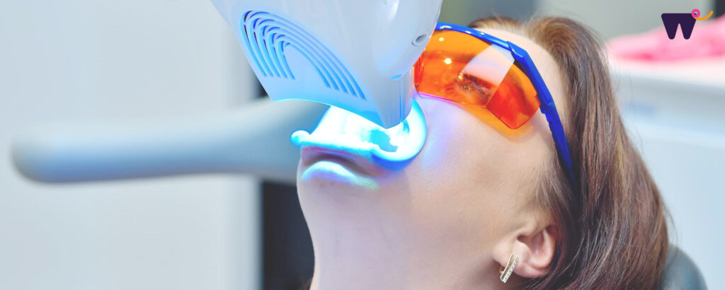 ฟอกสีฟันราคาเท่าไร ทำแล้วเสียวฟันไหม ตอบทุกคำถามที่ควรรู้ก่อนตัดสินใจทำ 2