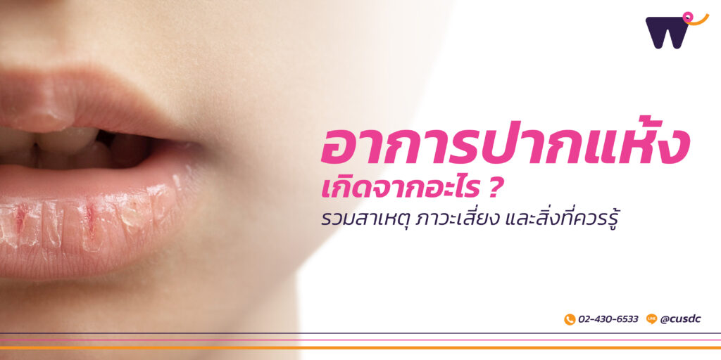 อาการปากแห้ง