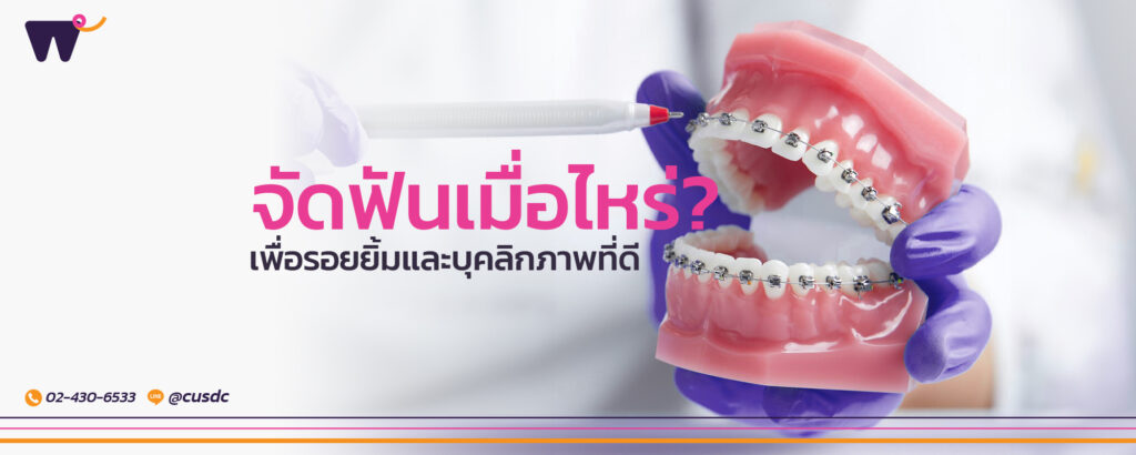 เริ่ม จัดฟันเมื่อไหร่ ดี? เพื่อรอยยิ้มและบุคลิกภาพที่ดี