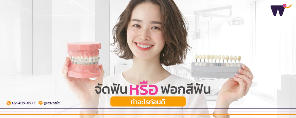 ข้อแนะนำระหว่าง "จัดฟัน" กับ "ฟอกสีฟัน" ควรเลือกทำอะไรก่อนดี ?
