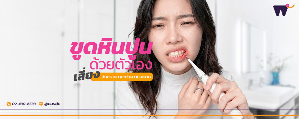 ขูดหินปูนด้วยตัวเอง อันตรายจากความเสี่ยงที่มากกว่าเรื่องความสะอาด