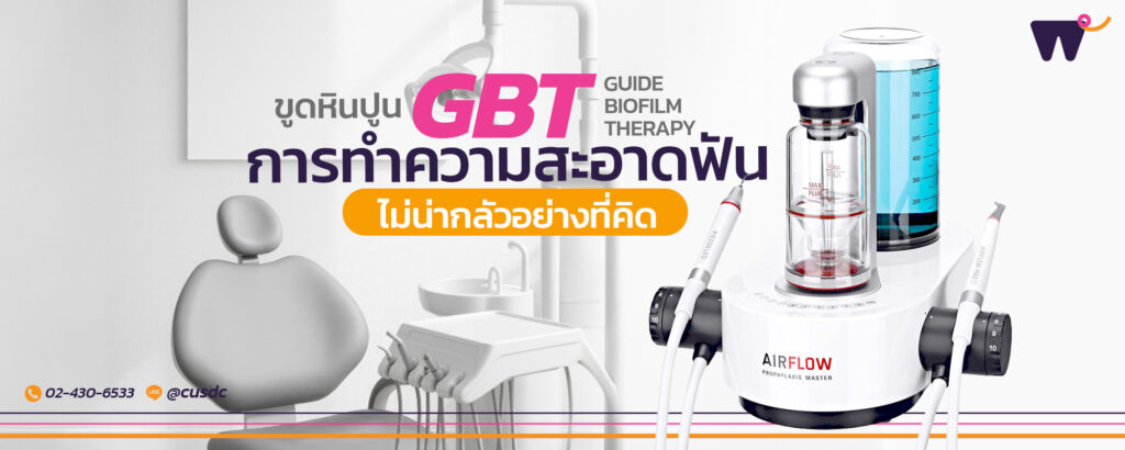 GBT (Guide Biofilm Therapy) : ทำไมการทำความสะอาดฟันในปัจจุบัน ถึงไม่น่ากลัวอย่างที่คิด ?